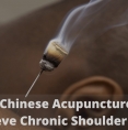 Acupuncture London