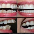 Cosmetic Dental Surgery